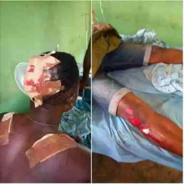 See What Scammers Did To This Man After Rejecting Their Business Offer (Graphic Photos)